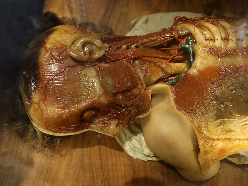 Museo delle cere anatomiche Clemente Susini